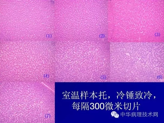 冰冻切片报告注意事项