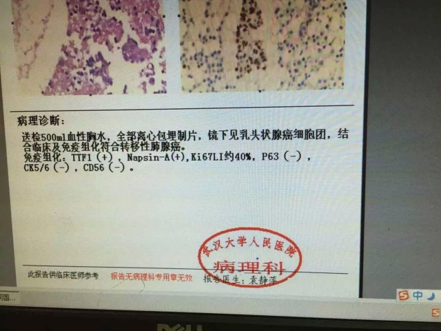 病理科新技术(一)：细胞蜡块