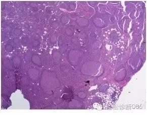 淋巴结T区和髓质组织学