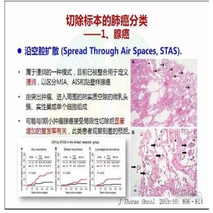 肺癌新分期和分类--临床和研究启示