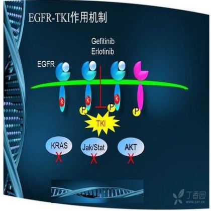 晚期非小细胞肺癌 EGFR-TKI 耐药研究进展