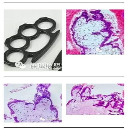 101诊断线索 笔记