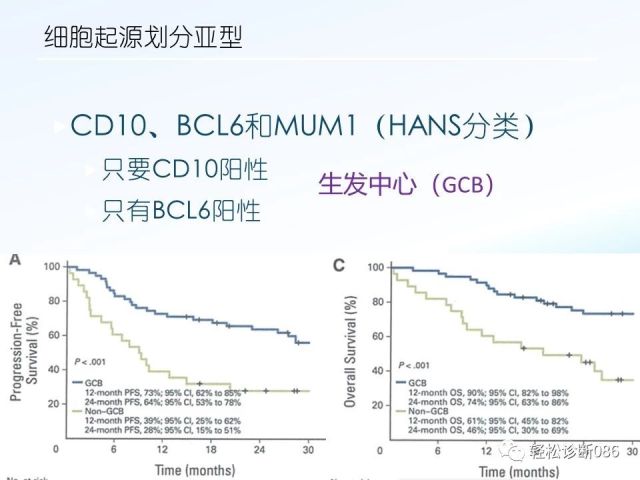 中枢神经系统弥漫大B细胞淋巴瘤