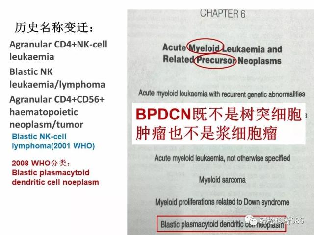 BPDCN病例分享