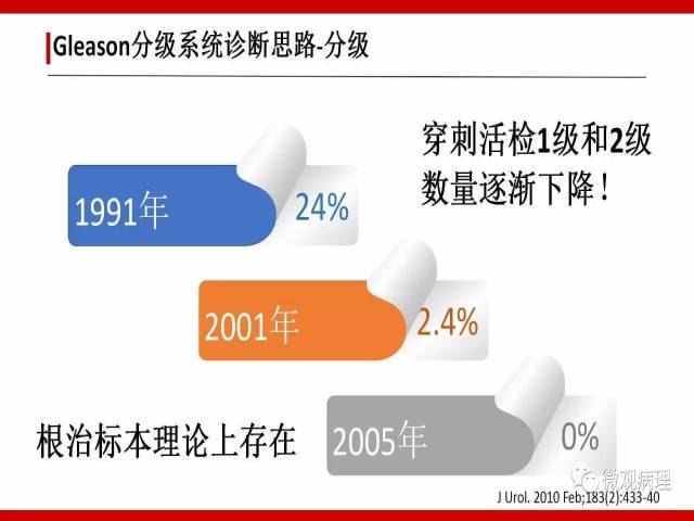 前列腺癌Gleason分级系统的前世今生