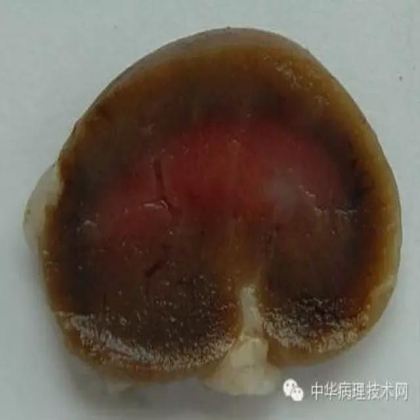 组织固定