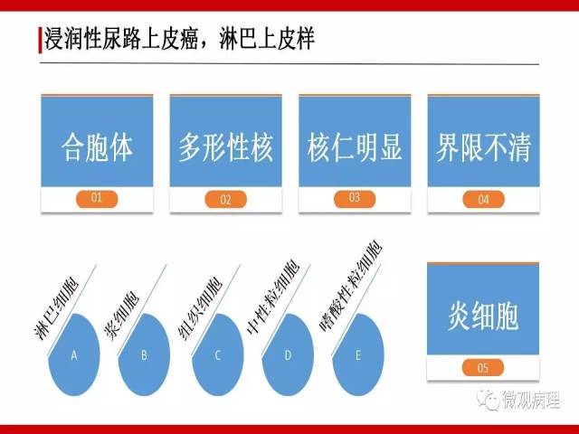 泌尿课程/浸润性尿路上皮癌病理学类型