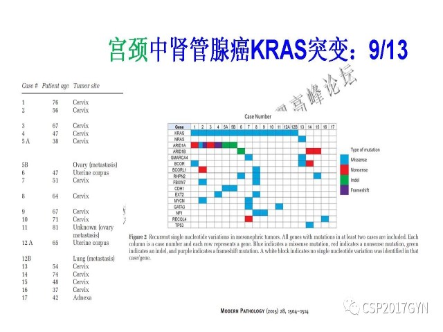 妇科肿瘤病理新进展——特殊类型的腺癌