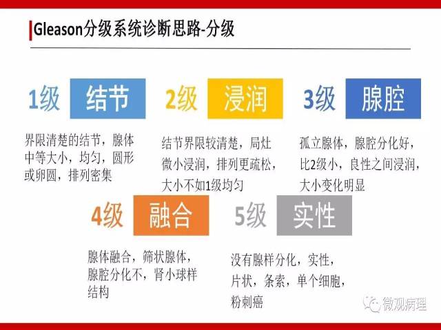 前列腺癌Gleason分级系统的前世今生