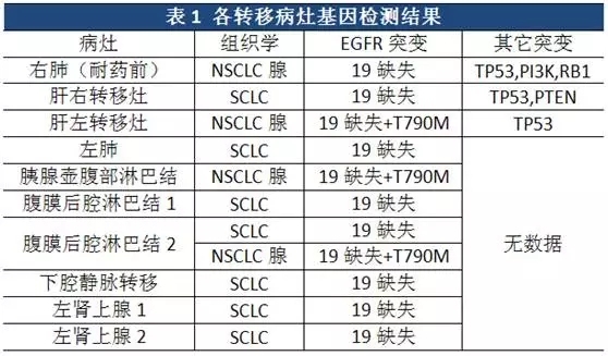 小细胞肺癌转化机制和治疗