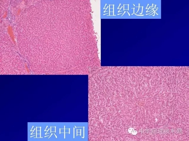 冰冻切片报告注意事项