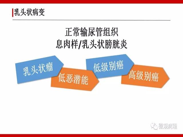 泌尿课程/非浸润性尿路上皮病变诊断的一些困惑
