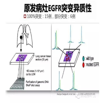 肿瘤精确医疗与分子病理检测