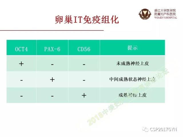 卵巢畸胎瘤诊断难点