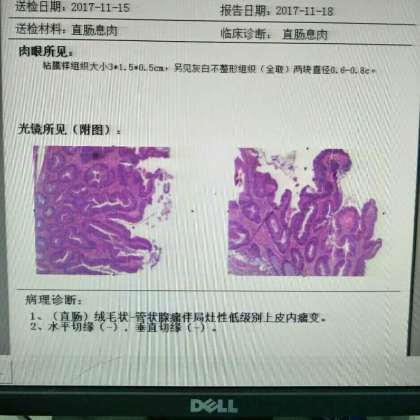 精准的病理诊断，才有精准的治疗