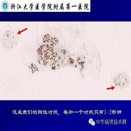 免疫组化液态阳性对照