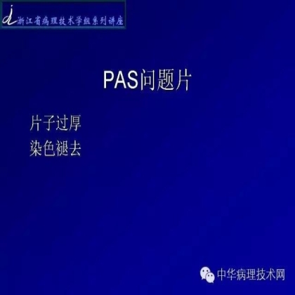 肾穿活检组织特殊染色方法