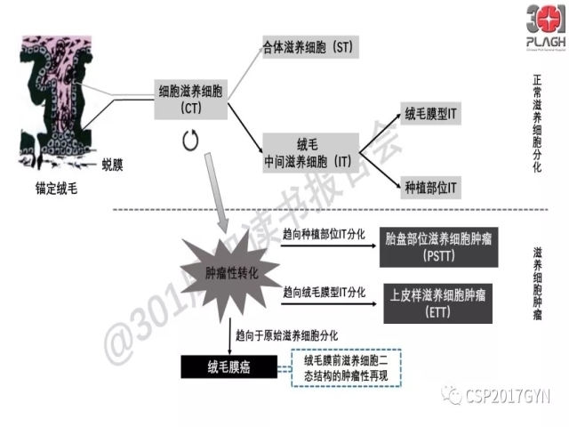 中间型滋养细胞肿瘤的诊断及鉴别诊断