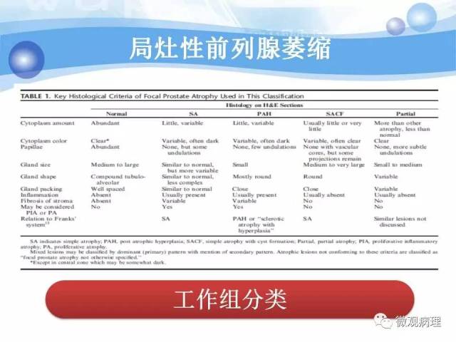 泌尿课程/局灶性前列腺萎缩