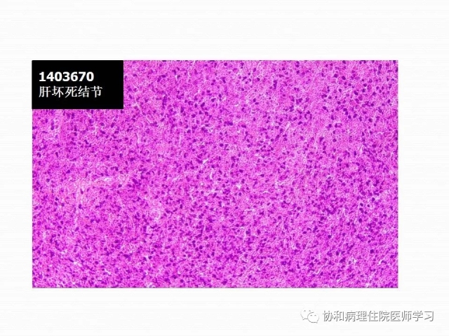 病理学基础知识 : 核分裂像的识别