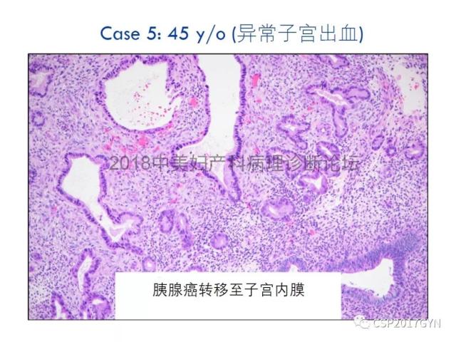 女性生殖道发育