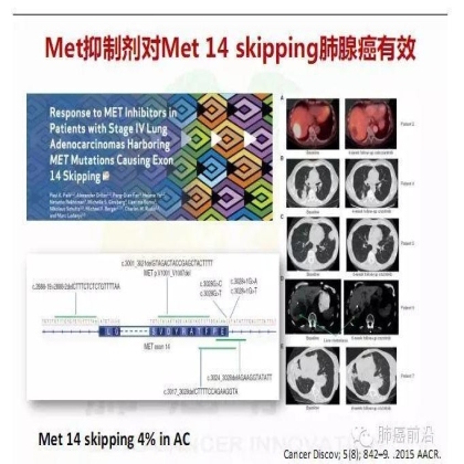 肺癌新分期和分类--临床和研究启示