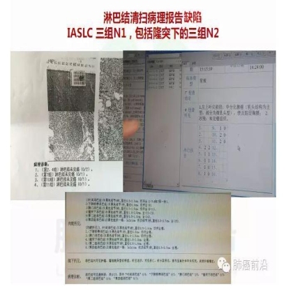 肺癌新分期和分类--临床和研究启示