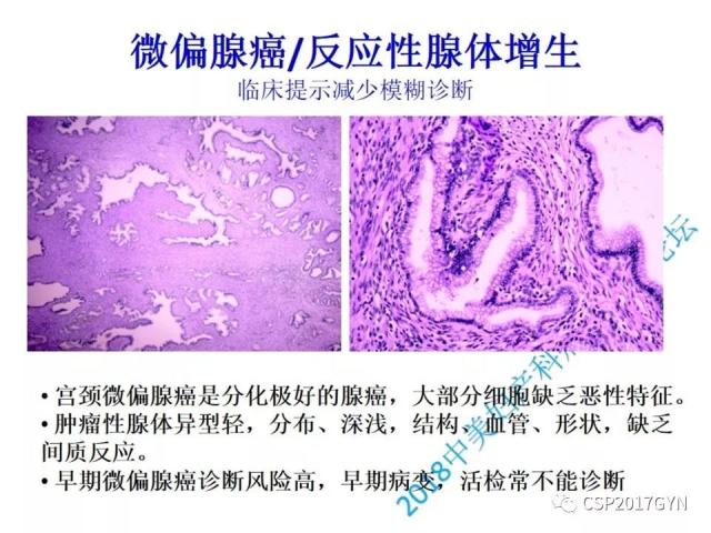 病理临床结合 开拓诊断视野