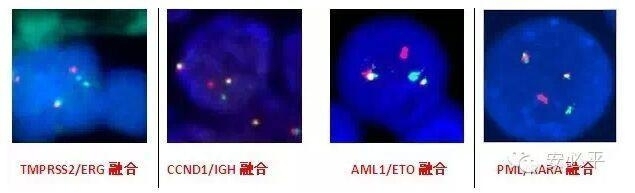 手把手教你建立FISH阈值