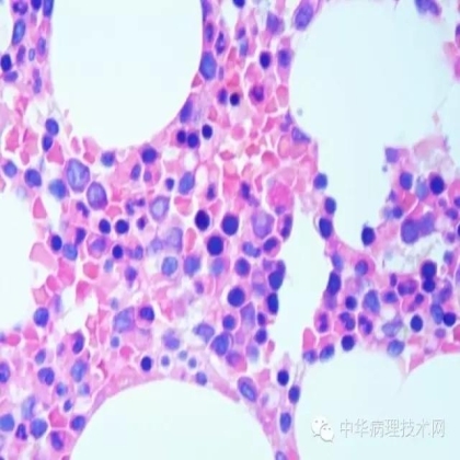 介绍几种日常工作中常见组织的脱钙方法