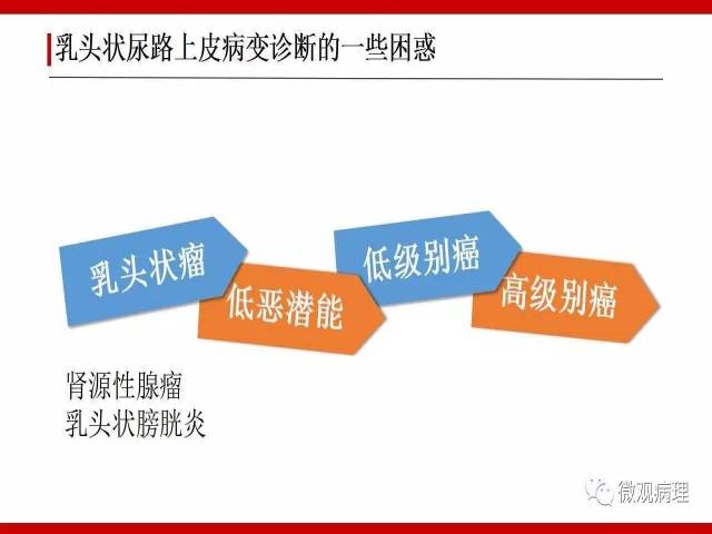 膀胱尿路上皮肿瘤诊断的一些困惑