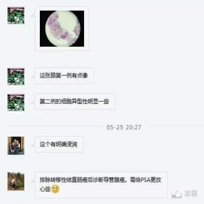 孔祥田(Max)*Roswell*NM老师分享前列腺癌病例