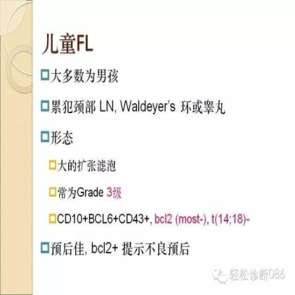 滤泡性淋巴瘤