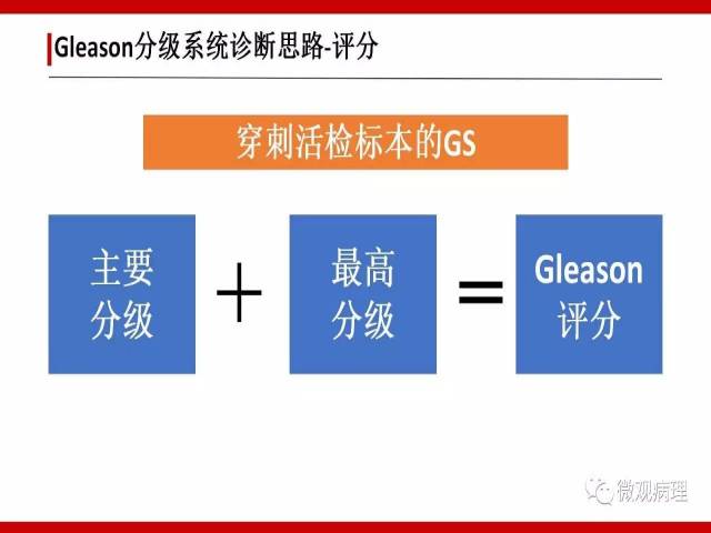 前列腺癌Gleason分级系统的前世今生