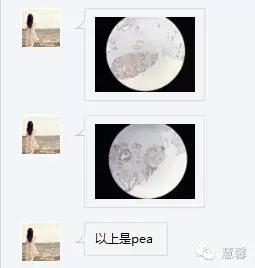 前列腺腺癌？（芳分享病例，华夏泌尿群讨论，孔祥田老师讲解）