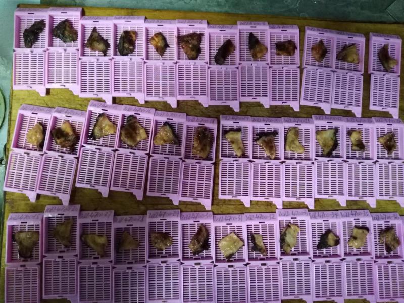 前列腺癌诊断的听课笔记（八十五）