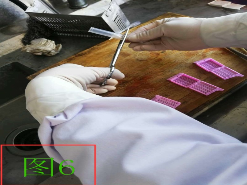 细胞蜡块的制作及应用举隅