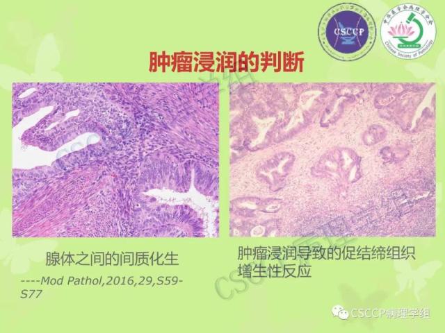 宫颈与子宫病变病理标本取材