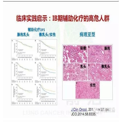 肺癌新分期和分类--临床和研究启示