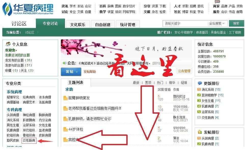 新专栏开设——炎症性肠病