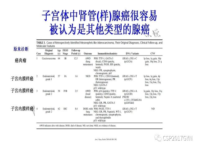 妇科肿瘤病理新进展——特殊类型的腺癌