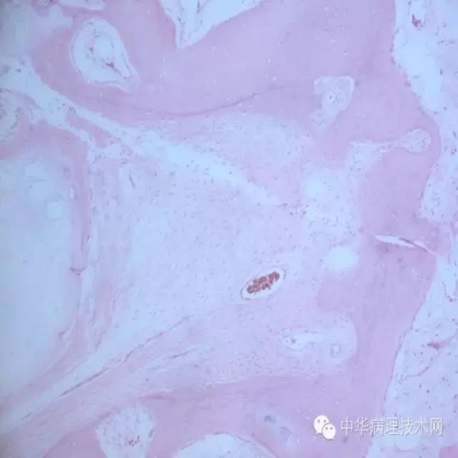 介绍几种日常工作中常见组织的脱钙方法