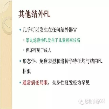 滤泡性淋巴瘤
