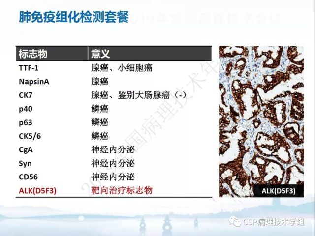 免疫组化检测的临床应用与质量评估