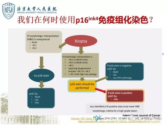 宫颈鳞状上皮内病变病理诊断中问题