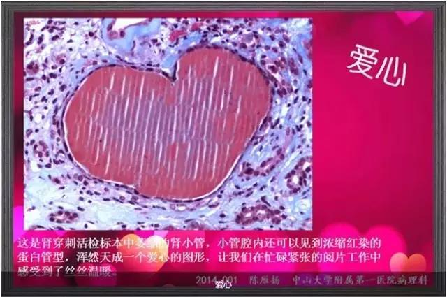 你见过这么美的病理切片吗？