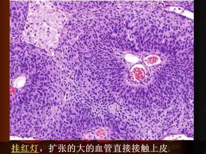 学习《病理诊断的关键点》：病理诊断中的“充分与必要”条件