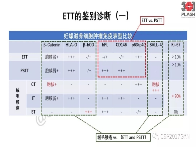 中间型滋养细胞肿瘤的诊断及鉴别诊断