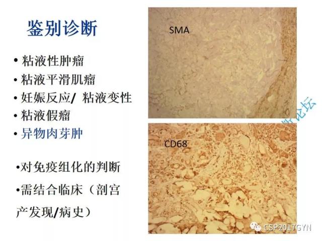 病理临床结合 开拓诊断视野