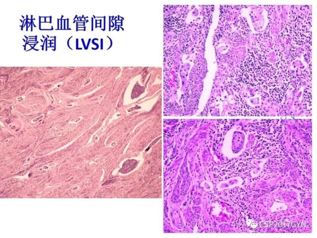 病理临床结合 开拓诊断视野